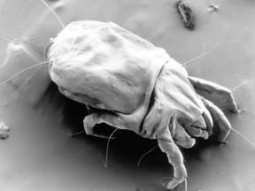 A scanning electron micrograph of a female dust mite