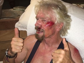 In a recent handout picture released by Virgin on August 26, 2016 British billionaire Richard Branson gives a thumbs up showing injuries after a biking accident on Virgin Gorda in the British Virgin Islands in the Caribbean. (AFP PHOTO/VIRGIN.COM)
