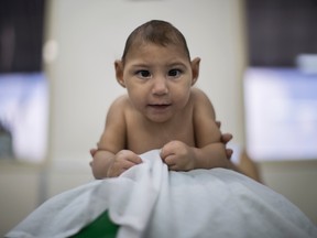 In this Sept. 28, 2016 photo, Helena Melo, who was born with microcephaly, balances on a ball during a physical therapy session at the AACD rehabilitation center in Recife, Brazil. Melo, 11 months old, travels more than two hours to Recife for therapy sessions three times a week. (AP Photo/Felipe Dana)