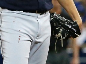 Blood drips down the hand of Indians starting pitcher Trevor Bauer during the first inning of Game 3 of the American League Championship Series in Toronto on Monday, Oct. 17, 2016. (Michael Peake/Toronto Sun)