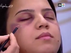 Sabahiyat, a Moroccan morning television show, apologized on Monday for airing a makeup tutorial that offered tips on disgusing signs of domestic abuse. (Screen capture)