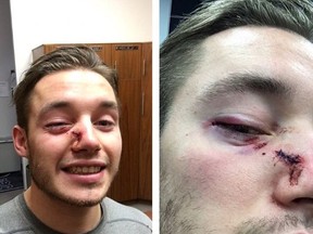 Winnipeg Jets winger Marko Dano was fortunate to not be more seriously injured after taking a stick to the face during Tuesday's game against the New Jersey Devils. (TWITTER PHOTO)