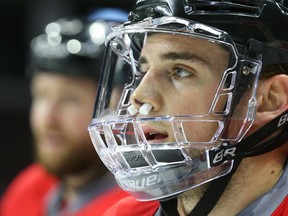 Senators defenceman Chris Weidman was in the lineup against the Sharks on Wednesday night after taking a puck in the face on Sunday. (Jean Levac/Postmedia Network)
