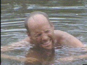 Michael Skupin winces in pain after badly burning his hands, face and shoulders during an episode of Survivor II: The Australian Outback.