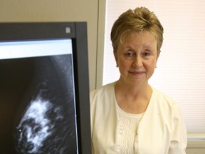 X-ray technologist Brenda Jarrell displays a mammogram. About 65 per cent of Ontario women eligible for the provincial breast screening program actually book mammograms. Luke Hendry/Postmedia Network