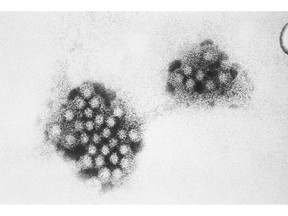 Norovirus . File Photo