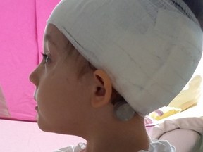 Little Lylah Fairless will have breast implants put on her head to save her life. (Lylah Fairless GoFundMe page)