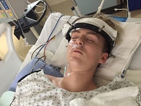 Landon Smith, 18, is recovering after spinal surgery on Jan. 10, 2017, following an injury he sustained while at a trampoline park in Sherwood Park.