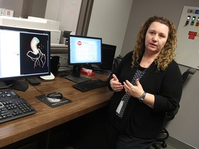 Jennifer McLardy, CT application specialist with GE, talks about Bluewater Health's new scanner's capabilities, as a cardiac scan shows on a screen. The $2.1-million machine started being used for patient scans Tuesday. (Tyler Kula/Sarnia Observer/Postmedia Network)