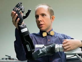 Roboticist Michael (Rory) Dawson poses for a photo with a Modular Prosthetic Limb that can feel and move like a human hand, in a Sensory Motor Adaptive Rehabilitation Technology (SMART) Network lab, at the Katz Group Centre for Pharmacy and Health Research, in Edmonton Thursday Jan. 12, 2017. David Bloom/Postmedia News