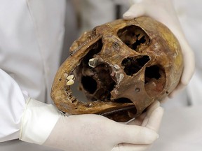 In this Dec. 7, 2016 photo, forensic doctor Daniel Munoz shows the skull of Nazi war criminal Josef Mengele, at the school of medicine of Sao Paulo University in Sao Paulo, Brazil. (AP Photo/Andre Penner)