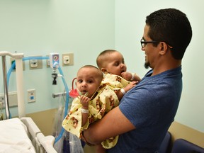 In this Nov. 2, 2016 photo provided by Westchester Medical Center Health Network, Marino Abel Camacho holds his conjoined daughters, Ballenie and Bellanie Camacho before surgery at Maria Fareri Children's Hospital in Valhalla, N.Y. More than 50 medical professionals helped perform the delicate 21-hour operation to separate the twins beginning Jan. 17, 2017. (Ben Cotten/WMCHealth via AP)