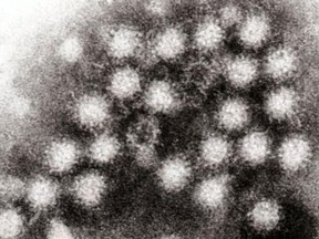 Huron County Health Unit issues an outbreak for norovirus. (Postmedia file photo)