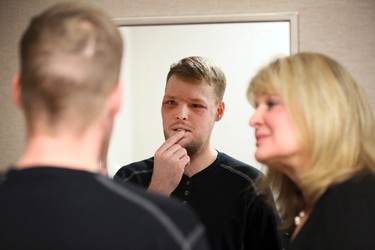 In this Jan. 24, 2017, photo, face transplant recipient Andy Sandness looks in a mirror during an appointment with physical therapist Helga Smars, right, at Mayo Clinic in Rochester, Minn. He wasn't allowed to see himself immediately after the surgery. His room mirror and cell phone were removed. When he finally did see his face after three weeks, he was overwhelmed. "Once you lose something that you've had forever, you know what it's like not to have it. ... And once you get a second chance to have it back, you never forget it." Just having a nose and mouth are blessings, Sandness says. "The looks are a bonus." (AP Photo/Charlie Neibergall) ORG XMIT: NY494