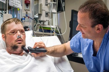 In this July 3, 2016 photo provided by the Mayo Clinic, Dr. Samir Mardini shaves the face of his patient, Andy Sandness, days after leading a team that performed the first face transplant surgery at the hospital. Over the years, the two say they've become as close as brothers. (Eric M. Sheahan/Mayo Clinic via AP) ORG XMIT: NY489