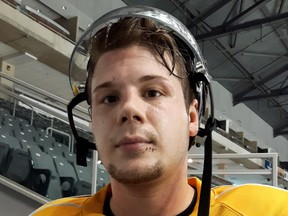 Kingston Frontenacs forward Cody Caron sports some stitches below his lip following a nasty skate-to-the-face incident in last Saturday's game against Oshawa. (Doug Graham/The Whig-Standard)