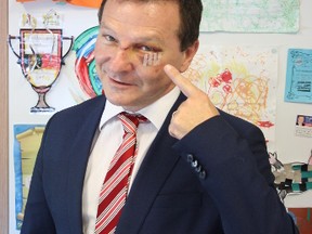 In this May 3, 2017, photo, Australian lawmaker Graham Perrett poses in his office in the city of Brisbane, Australia to show his injuries sustained three days earlier while watching the satirical U.S. TV series Veep at home. Perrett says he was stunned that he had grabbed the attention of Veep stars by simply laughing so hard at an episode of the political satire that he choked on his sushi and knocked himself unconscious on a kitchen bench. (AP Photo/Ben Driscoll)