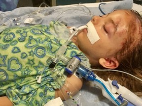 Lennox Lake, 6, will recover from his injuries. (GOFUNDME)