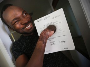 Seidu Mohammed smiles as he shows off his refugee claim acceptance letter in Winnipeg, Thursday, May 18, 2017. A man who walked across the United States border into Manitoba and lost all his fingers to frostbite has won the right to stay in Canada. THE CANADIAN PRESS/John Woods