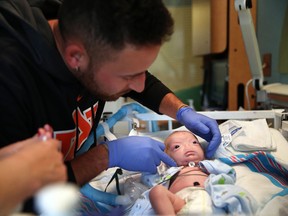 Troy Thompson tends to his son, Eli at the NICU at USA Children’s and Women’s Hospital in Mobile, Ala., on March 19, 2015. (AP Photo/AL.com, Sharon Steinmann)