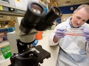 Dr. Dean Befus poses for a photo with a culture of epithelium cells in his lab at the University of Alberta, in Edmonton Monday June 26, 2017. Beaus is a lead researcher on a study finding a link between a salivary gland protein and human stress levels. David Bloom/Postmedia