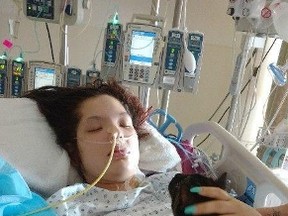 Chey Alvarez, 21, of Surrey was bitten on June 3 by what her family believes was a brown recluse spider. (GOFUNDME/PHOTO)