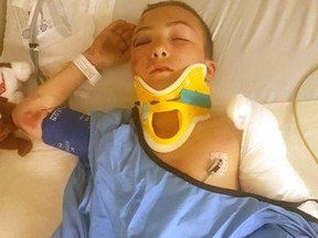 James Dubuc, 11, was hit by a car in Schumacher on July 7. His mother says he was running from another child who was wielding a knife.
