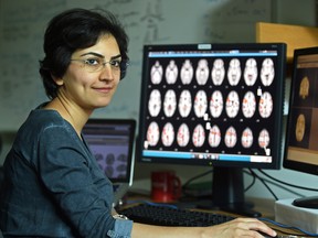 Mina Gheiratmand, primary author of the research study using brain MRI scans to identify schizophrenia in patients. (ED KAISER)