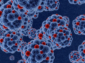 HIV cells attacking organism (file, Getty Images)