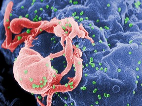 This undated photo provided by the Centers for Disease Control and Prevention shows a scanning electron micrograph of multiple round bumps of the HIV-1 virus on a cell surface. In a report released on Monday, July 24, 2017, researchers said a South African girl born with the AIDS virus has kept her infection suppressed for 8 1/2 years after stopping anti-HIV medicines _ more evidence that early treatment can occasionally cause a long remission that, if it lasts, would be a form of cure. (Cynthia Goldsmith/Centers for Disease Control and Prevention via AP)