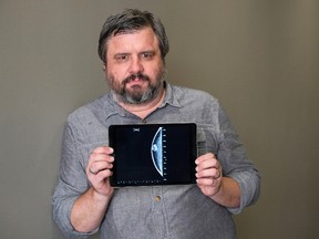 In this July 13, 2017 photo, Associated Press reporter Andrew Dalton holds an iPad displaying an image of his mammogram in downtown Los Angeles. Dalton described his experience as the rare man who underwent a mammogram in a story for the AP. (AP Photo/Richard Vogel)