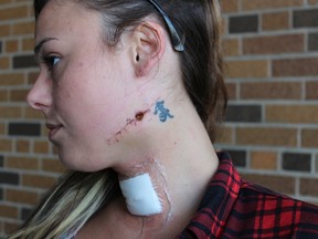 Lexie was stabbed in the neck in front of the Goodwill centre two weeks ago. She says she surprised herself with her will to survive. (CHARLIE PINKERTON, The London Free Press)