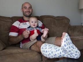 Rugby player Ethan Fournier with his broken leg and his six month old son Henry in London. (DEREK RUTTAN, The London Free Press)