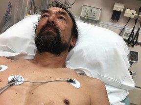 This photo provided by Donna Bergeson on June 25, 2017, her husband Doug Bergeson lies on a hospital bed at Aurora BayCare Medical Center in Green Bay, Wis., before a doctor removed a nail from his heart. He had accidentally shot it into his heart earlier in the day while working on a new house in Peshtigo, Wis. He survived and is going back to work this week. (Donna Bergeson via AP)