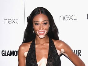 Winnie Harlow attends the Glamour Women of The Year awards 2017 at Berkeley Square Gardens on June 6, 2017 in London. (Stuart C. Wilson/Getty Images)