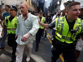 Police escort an injured man who was assaulted while arguing with counterprotesters long after a "Free Speech" rally was staged by conservative activists, Saturday, Aug. 19, 2017, in Boston. (AP Photo/Michael Dwyer)