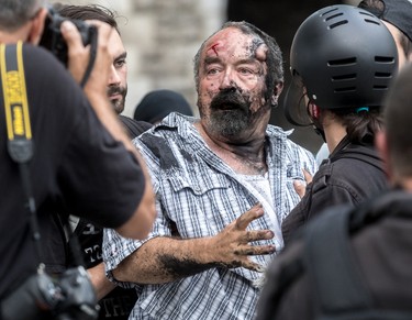 The far-right group La Meute and counter-protesters, organized by a group called Citizen Action Against Discrimination as well as the Ligue anti-fasciste Québec clashed in Quebec City, on Sunday, August 20, 2017. Eric Roy was confronted by protesters and eventually suffered a every bruised skull. (Dave Sidaway / MONTREAL GAZETTE)