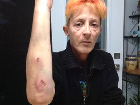 Carole Tessier says she was attacked by a dog outside her home in Iroquois Falls in an attack that left her dog, Marley, injured. Tessier has had to put Marley down - but is in the dark about the fate of the dog she says attacked her.