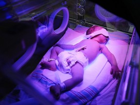 Luke Hendry/The Intelligencer
Declan Howat, of Tweed, sleeps while receiving double phototherapy, a treatment for jaundice, four days after his birth at Belleville General Hospital Thursday, November 2. About two-thirds of babies develop jaundice.