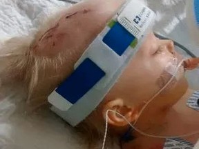 Kody Smart in intensive care at a Hamilton Hospital in July 2015. Supplied photo