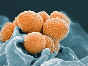 This handout image provided by the National Institute of Allergy and Infectious Diseases shows an electron microscope image of Group A Streptococcus (orange) during phagocytic interaction with a human neutrophil (blue). Health officials have issued an alert, saying nine people have died in an ongoing invasive group. A streptococcus outbreak in the London, Ont., area. THE CANADIAN PRESS/AP-National Institute of Allergy and Infectious Diseases via AP
