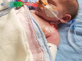 Photo supplied
Only a couple of days old, Elijah Hennessey had to undergo surgery at Toronto’s Hospital for Sick Children. Elijah has several medical conditions. His parents are Jessie Hennessey and Thomas Wallace of Elliot Lake.
