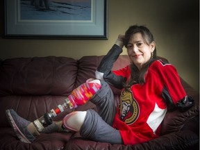 Christine Caron at her Ottawa home Saturday January 6, 2018. Caron has some heart-felt advice for Sabryna Mongeon, the young Outaouais woman who has undergone multiple ambputations after a holiday car crash. Ashley Fraser/Postmedia