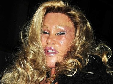 In this July 10, 2009 file photo, Jocelyn Wildenstein arrives at the 'Le Cirque' restaurant with her boyfriend in New York City. Wildenstein is famous for reportedly spending millions on plastic surgery procedures. (WENN.com)