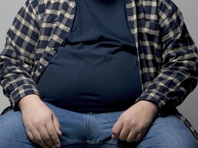 Obesity: An epidemic.
