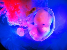 A human embryo is pictured in the eighth week of pregnancy in this undated photo by Swedish photographer Lennart Nilsson.