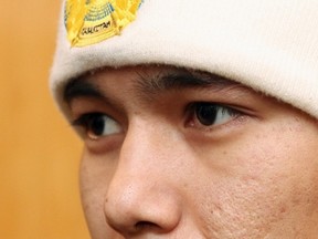 A prisoner on a hunger strike has his mouth sewn with a wire at a prison in Bishkek on January 24, 2012. (REUTERS/Vladimir Pirogov)
