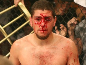 Nick Diaz, seen bloodied here from a previous fight, announced his retirement from the octagon after losing to Carlos Condit last weekend. But few believe him.