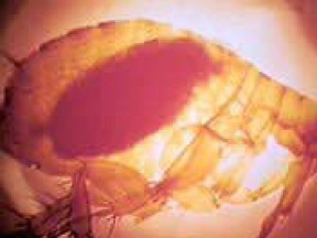 A flea engorged with blood. Infected fleas can spread the plague to humans and animals with bites. (Handout/Center for Disease Control)