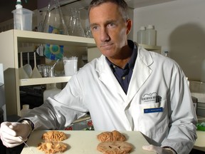 Neuropathologist Dr. Ian Mackenzie with brain tissue from dementia patients